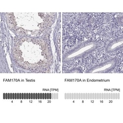 FAM170A Antibody, Novus Biologicals 0.1mL; Unlabeled:Antibodies, Polyclonal
